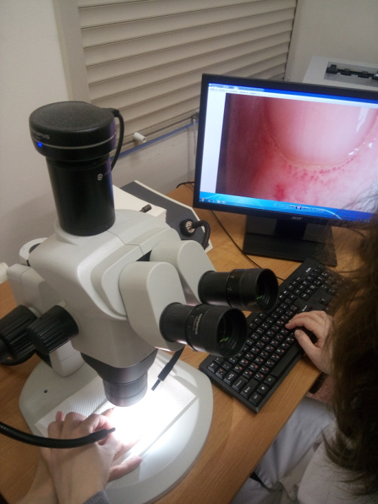 Видеокапилляроскопия ногтевого ложа